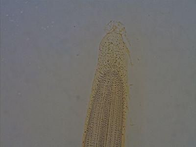 Onion Tip